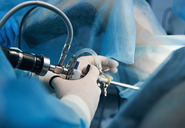 Hysteroscopic surgery